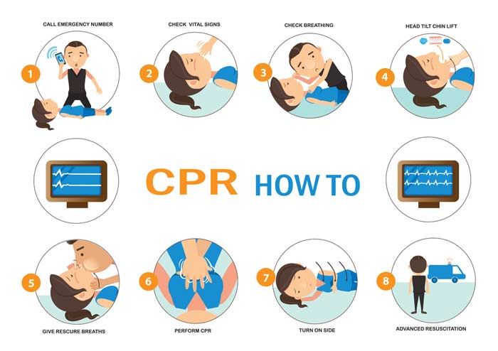 what the steps of CPR are